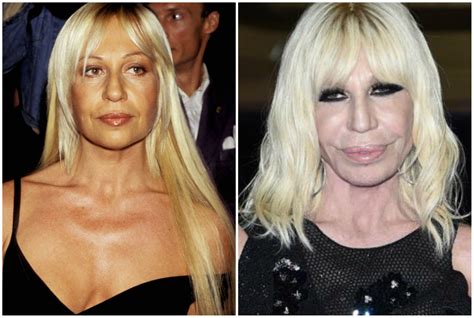 donatella versace prima e adesso|where is donatella versace now.